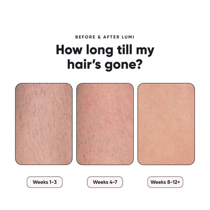 Lumi Permanent Hair Removal Device