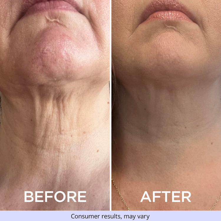 TIGHTEN & LIFT NECK CREAM